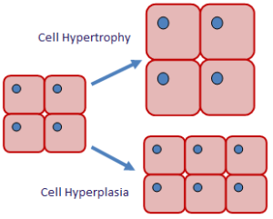 hyperplasia vs hypertrophy