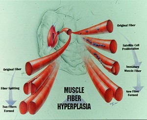 hyperplasia